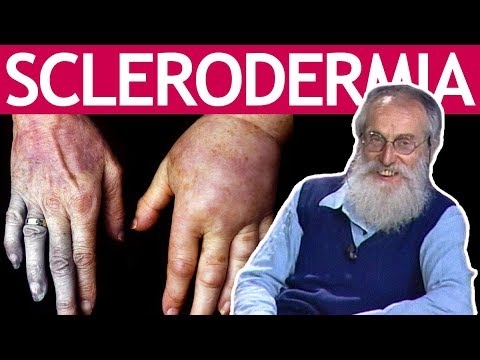 X Disease Of Cherries - Che cosa è la malattia di pelle di daino ciliegia
